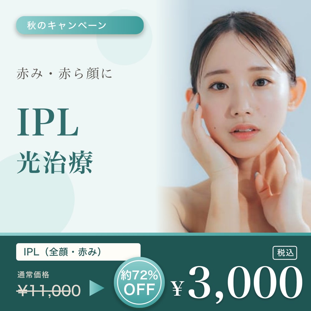 IPL 全顔（赤み） 通常¥11,000 → 秋のキャンペーン価格 ¥3,000 税込