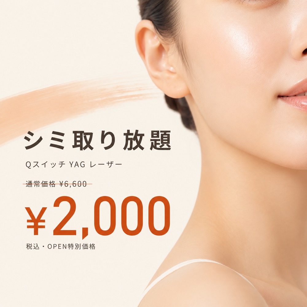 シミ取り放題（Qスイッチ YAGレーザー）通常¥6,600 → オープン特別価格 ¥2,000 税込